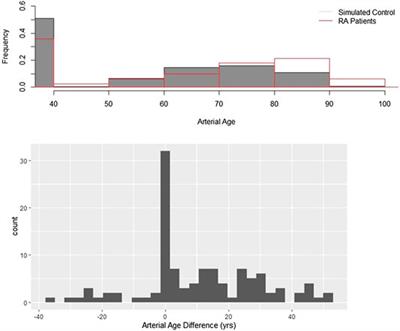 Largely Accelerated Arterial Aging in Rheumatoid Arthritis Is Associated With Inflammatory Activity and Smoking in the Early Stage of the Disease